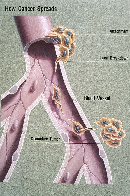 This image is a work of the National Institutes of Health, part of the United States Department of Health and Human Services. As a work of the U.S. federal government, the image is in the public domain.