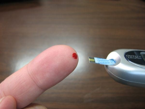 blodprov finger